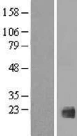 Novus Biologicals&trade;&nbsp;IL-38/IL-1F10 Overexpression Lysate