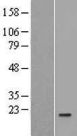 Novus Biologicals&trade;&nbsp;IL-36Ra/IL-1F5 Overexpression Lysate