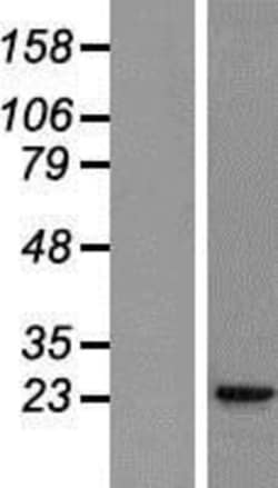 Novus Biologicals&trade;&nbsp;IL-37/IL-1F7 Overexpression Lysate