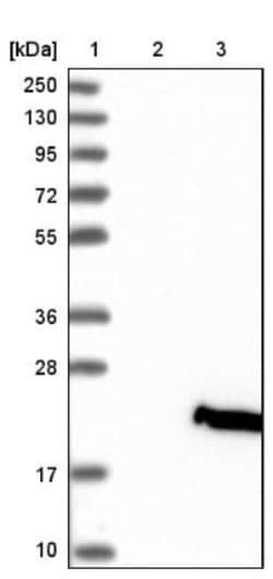 IL-36 beta/IL-1F8 Antibody, Novus Biologicals:Antibodies:Primary Antibodies