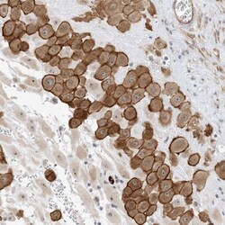 IL-36 beta/IL-1F8 Antibody, Novus Biologicals:Antibodies:Primary Antibodies