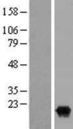 Novus Biologicals&trade;&nbsp;IL-36 gamma/IL-1F9 Overexpression Lysate