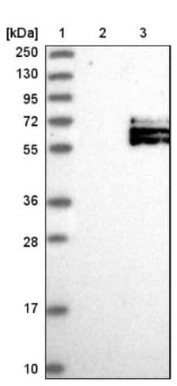 IL-1 RII Antibody, Novus Biologicals 0.1mL; Unlabeled:Antibodies, Polyclonal
