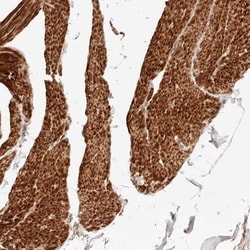 IL-1 RII Antibody, Novus Biologicals 0.1mL; Unlabeled:Antibodies, Polyclonal