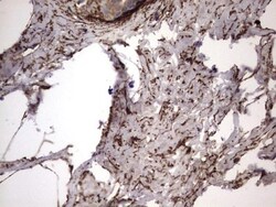 IL-1ra/IL-1F3/IL1RN Antibody (OTI2B1), Novus Biologicals 0.1mL; Unlabeled:Antibodies,