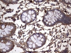 IL-1ra/IL-1F3/IL1RN Antibody (OTI2B1), Novus Biologicals 0.1mL; Unlabeled:Antibodies,