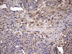 IL-1ra/IL-1F3/IL1RN Antibody (OTI2B1), Novus Biologicals 0.1mL; Unlabeled:Antibodies,