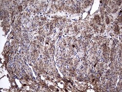 IL-1ra/IL-1F3/IL1RN Antibody (OTI2B1), Novus Biologicals 0.1mL; Unlabeled:Antibodies,