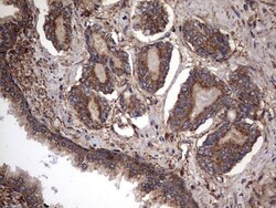 IL-1ra/IL-1F3/IL1RN Antibody (OTI2B1), Novus Biologicals 0.1mL; Unlabeled:Antibodies,