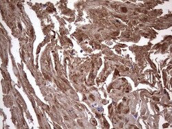 IL-1ra/IL-1F3/IL1RN Antibody (OTI2B1), Novus Biologicals 0.1mL; Unlabeled:Antibodies,