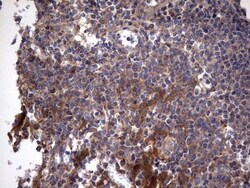 IL-1ra/IL-1F3/IL1RN Antibody (OTI2B1), Novus Biologicals 0.1mL; Unlabeled:Antibodies,