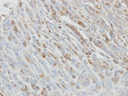 IL-1ra/IL-1F3/IL1RN Antibody, Novus Biologicals 100 &mu;L | Buy Online | Novus Biologicals | Fisher Scientific