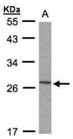 IL-1ra/IL-1F3/IL1RN Antibody, Novus Biologicals 100 &mu;L | Buy Online | Novus Biologicals | Fisher Scientific