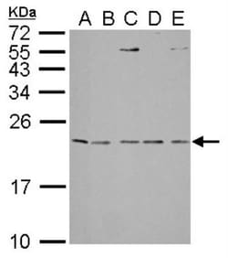 IL-1ra/IL-1F3/IL1RN Antibody, Novus Biologicals 100 &mu;L | Buy Online | Novus Biologicals | Fisher Scientific