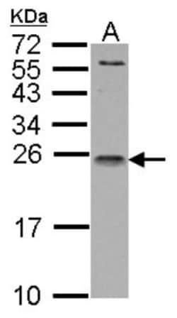 IL-1ra/IL-1F3/IL1RN Antibody, Novus Biologicals 100 &mu;L | Buy Online | Novus Biologicals | Fisher Scientific