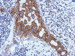 IL-1 RAcP/IL-1 R3 Antibody, Novus Biologicals 0.1mL; Unlabeled:Antibodies,