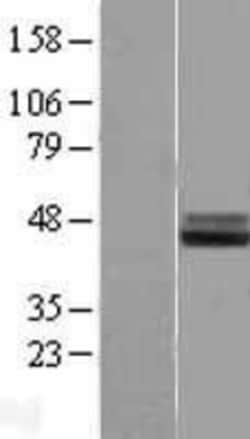 Novus Biologicals&trade;&nbsp;IL-1 RAcP/IL-1 R3 Overexpression Lysate