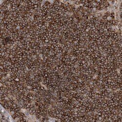 IL1RAPL2 Antibody, Novus Biologicals 25 μL; Unlabeled:Antibodies, Polyclonal
