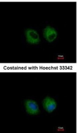IL-1 RII Antibody, Novus Biologicals 0.1mg; Unlabeled:Antibodies, Polyclonal