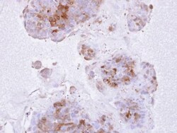 IL-1 RII Antibody, Novus Biologicals 0.1mg; Unlabeled:Antibodies, Polyclonal