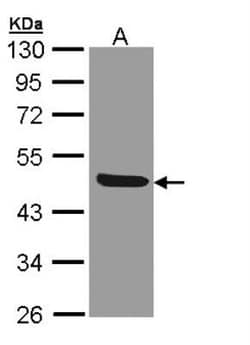 IL-1 RII Antibody, Novus Biologicals 0.1mg; Unlabeled:Antibodies, Polyclonal