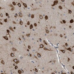 IL-1Rrp2/IL-1R6 Antibody, Novus Biologicals:Antibodies:Primary Antibodies