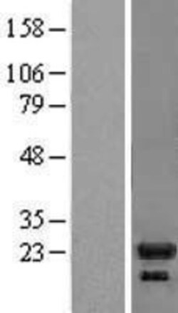 Novus Biologicals&trade;&nbsp;IL-1ra/IL-1F3/IL1RN Overexpression Lysate