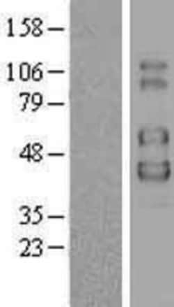 Novus Biologicals&trade;&nbsp;Common gamma Chain/IL-2 R gamma Overexpression Lysate