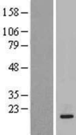 Novus Biologicals&trade;&nbsp;IL-20 Overexpression Lysate