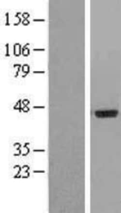 Novus Biologicals&trade;&nbsp;IL-20R alpha Overexpression Lysate