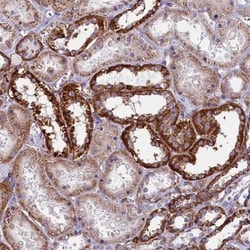 IL-20R alpha Antibody, Novus Biologicals 0.1mL; Unlabeled:Antibodies, Polyclonal
