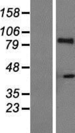 Novus Biologicals&trade;&nbsp;IL-21R Overexpression Lysate