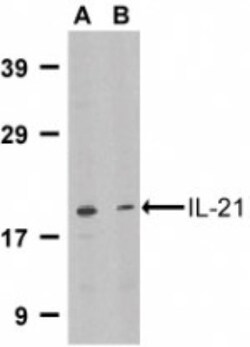 IL-21 Antibody - BSA Free, Novus Biologicals 0.1mg; Unlabeled:Antibodies,