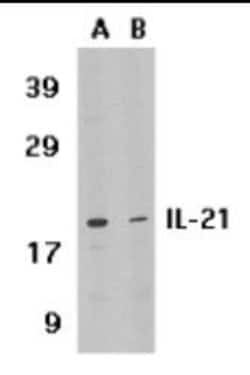Novus Biologicals™ IL-21 Antibody Blocking Peptide