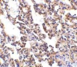 IL-21R Antibody - BSA Free, Novus Biologicals 0.1mg; Unlabeled:Antibodies,