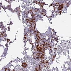 IL-21R Antibody, Novus Biologicals:Antibodies:Primary Antibodies