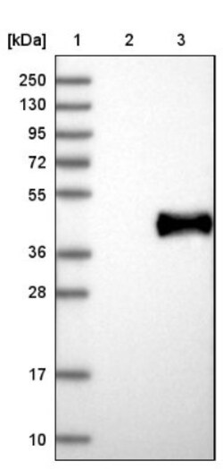 IL-22BP/IL22 RA2 Antibody, Novus Biologicals 0.1 mL | Buy Online | Novus Biologicals | Fisher Scientific