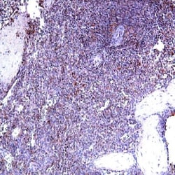 IL-22BP/IL22 RA2 Goat anti-Human, Mouse, Rat, Polyclonal, Novus Biologicals:Antibodies:Primary