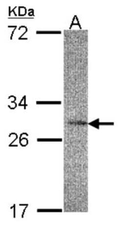 IL-22BP/IL22 RA2 Antibody, Novus Biologicals 0.1 mL | Buy Online | Novus Biologicals | Fisher Scientific