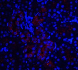IL-22R alpha 1 Antibody - BSA Free, Novus Biologicals 0.025 mg, Unconjugated:Antibodies,