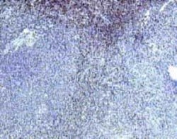 IL-22R alpha 1 Goat anti-Human, Polyclonal, Novus Biologicals 0.025 mg;