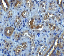 IL-22R alpha 1 Antibody - BSA Free, Novus Biologicals 0.025 mg, Unconjugated:Antibodies,