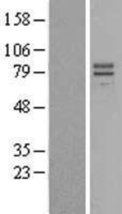 Novus Biologicals&trade;&nbsp;IL-23R Overexpression Lysate