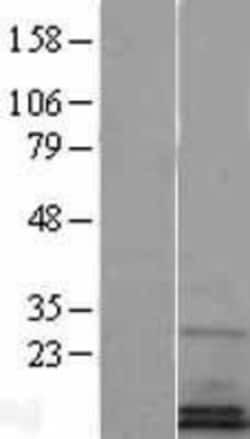 Novus Biologicals&trade;&nbsp;SF20/MYDGF Overexpression Lysate