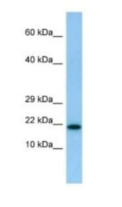IL-26/AK155 Antibody, Novus Biologicals 100&mu;L; Unlabeled:Antibodies,