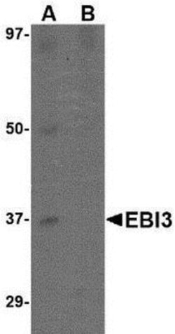 EBI3 Antibody - BSA Free, Novus Biologicals 0.1mg; Unlabeled:Antibodies,