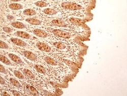 IL-27R alpha/WSX-1/TCCR Antibody (34N4G11) - BSA Free, Novus Biologicals:Antibodies:Primary