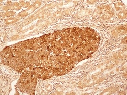IL-27R alpha/WSX-1/TCCR Antibody (34N4G11) - BSA Free, Novus Biologicals:Antibodies:Primary