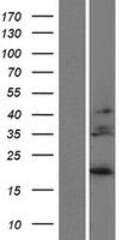 Novus Biologicals&trade;&nbsp;IL-28B/IFN-lambda 3 Overexpression Lysate