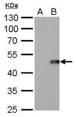 IL-28B/IFN-lambda 3 Antibody (617), Novus Biologicals 0.1 mL | Buy Online | Novus Biologicals | Fisher Scientific